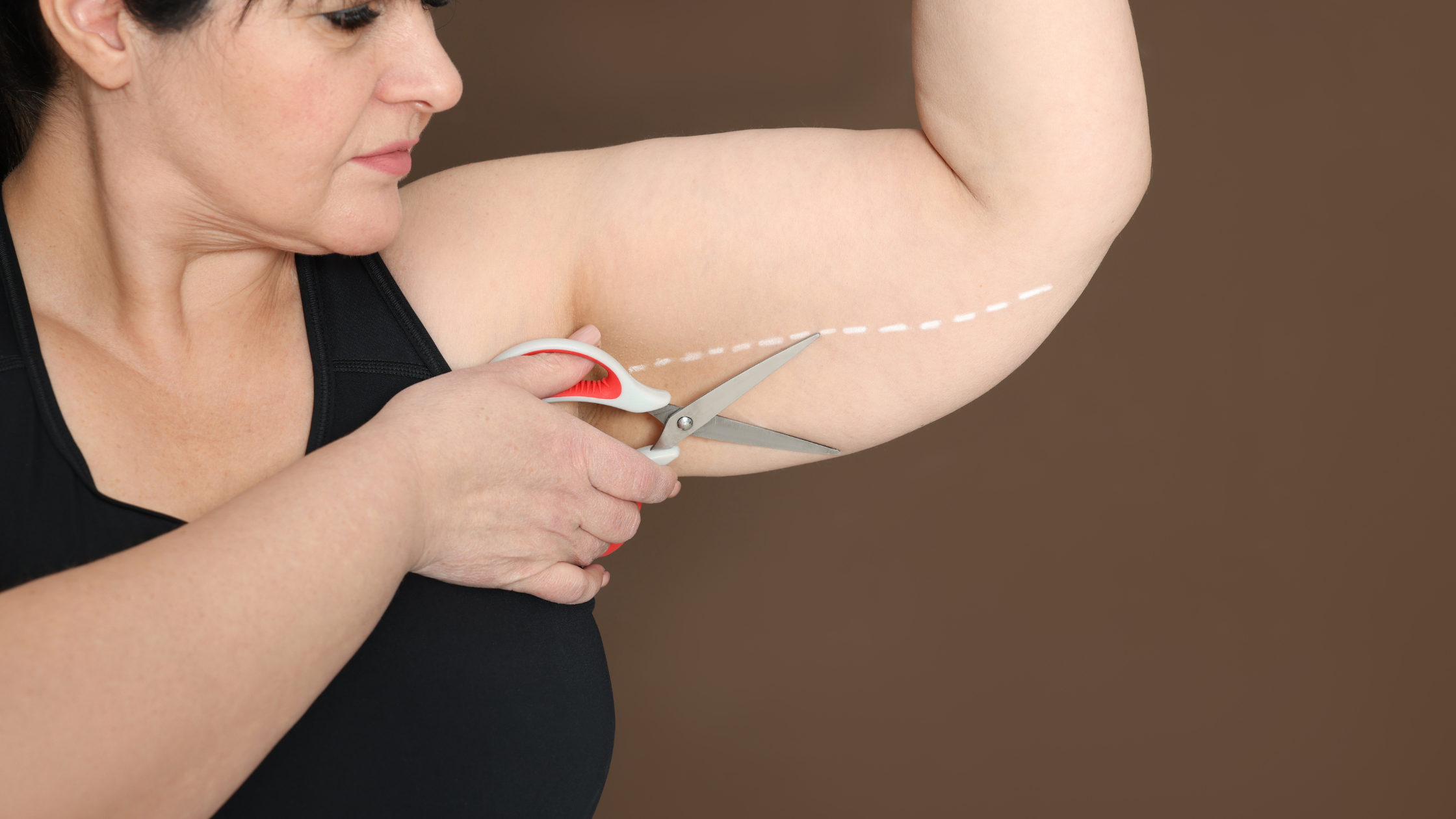 tipos de cirurgia bariátrica qual escolher