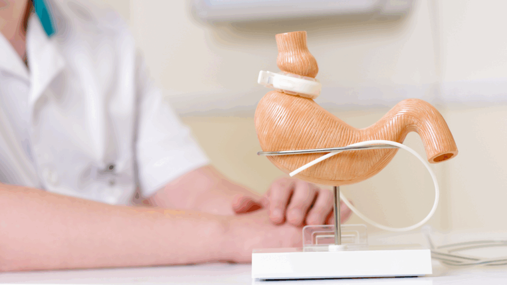 Convênio Unimed cobre cirurgia bariátrica