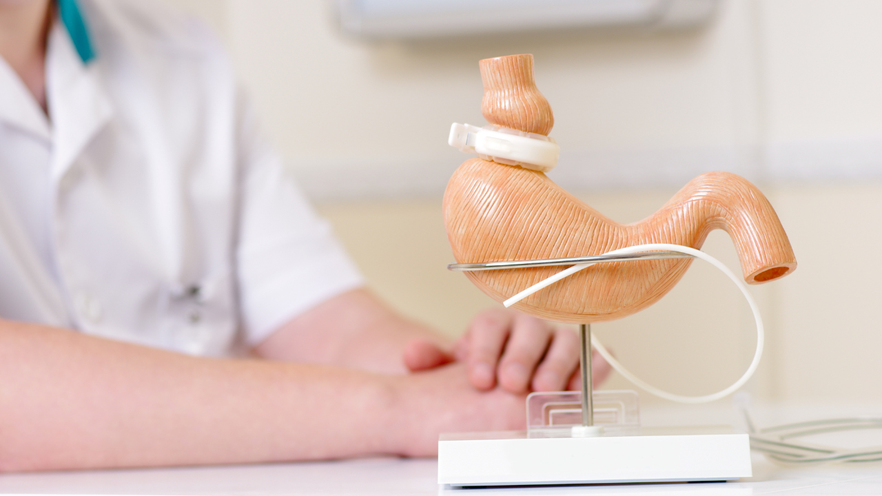 Cirurgia bariátrica gratuita pelo SUS ou plano de saúde: qual vale mais a pena para você?