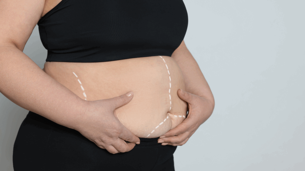 Cirurgia bariátrica pela Porto Seguro