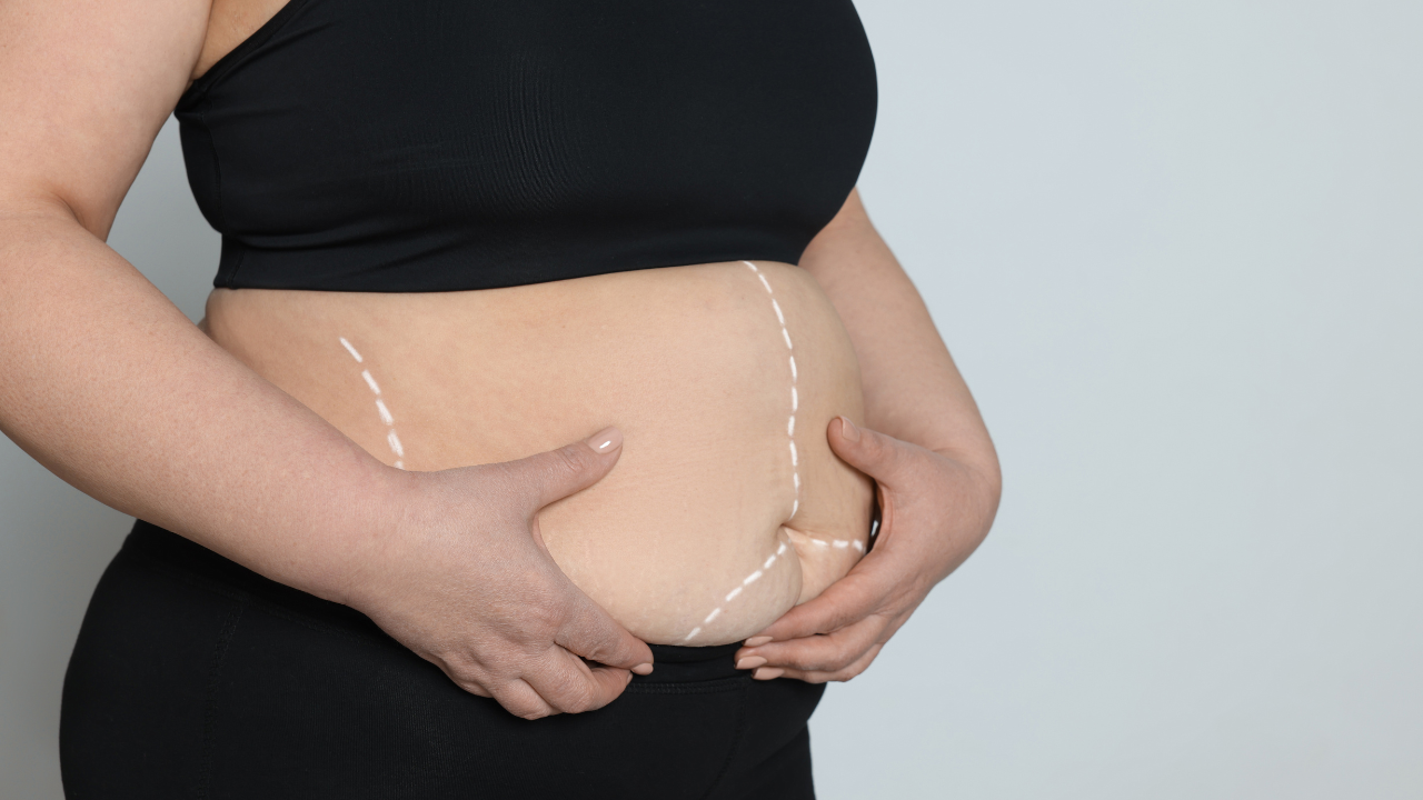 Cirurgia bariátrica pela Porto Seguro