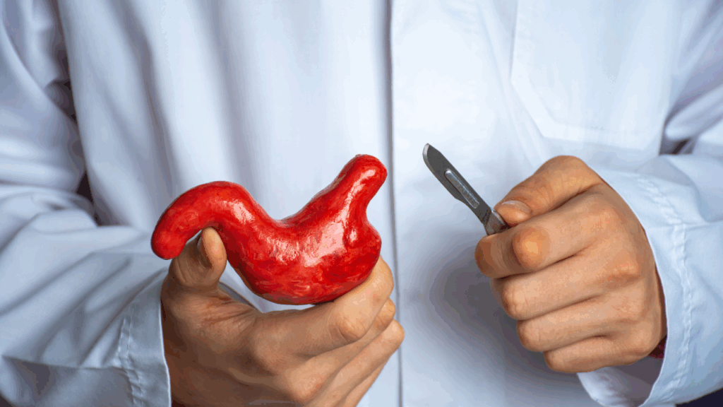 Cirurgia bariátrica pelo convênio Amil: entenda as regras e como acelerar o processo