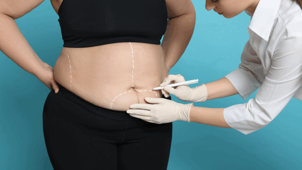 Plano Care Plus cobre cirurgia bariátrica? Saiba o que está incluso no convênio premium